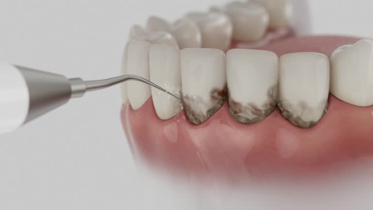 Reliable Dental contractor in Middletown, CA by Smile Center Dentistry